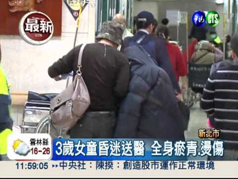 全身淤燙傷!3歲女童遭保母虐死