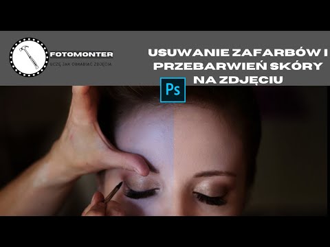 Usuwanie zafarbów i przebarwień skóry na zdjęciu