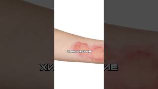 В Иране Выпал ЧЁРНЫЙ Ядовитый Дождь