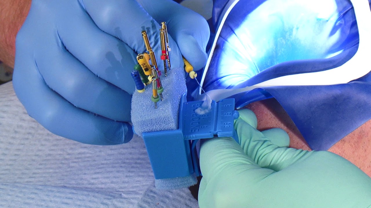 Réalisation d'un traitement endondontique