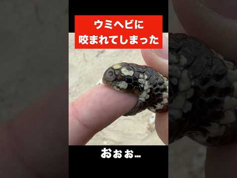 ウミヘビに咬まれてみた