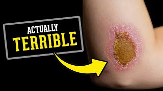 Why “Drying It Out” is the WORST Way to Heal