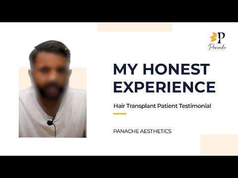 Hair Transplant Result Experience