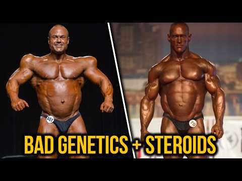 The UGLIEST Shapes in Bodybuilding!