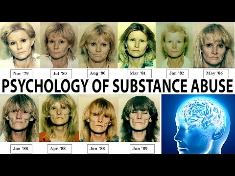 download lagu mp3 mp4 Psychological Dependence, download lagu Psychological Dependence gratis, unduh video klip Psychological Dependence