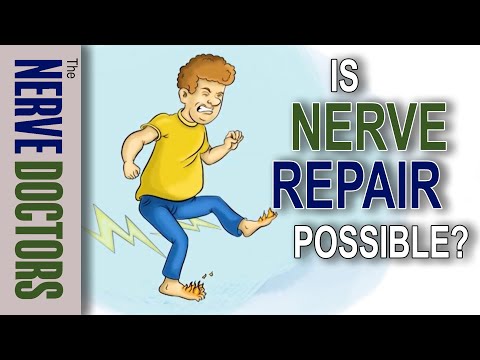 Is Nerve Repair Possible? - The Nerve Doctors