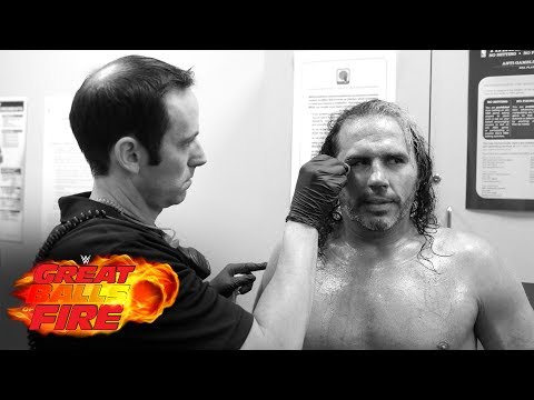 Post Great Balls Of Fire Fight-Size Update: Matt Hardy Gets Stitches, Fallout And Raw Talk Videos, WWE 24 Vignette, More
