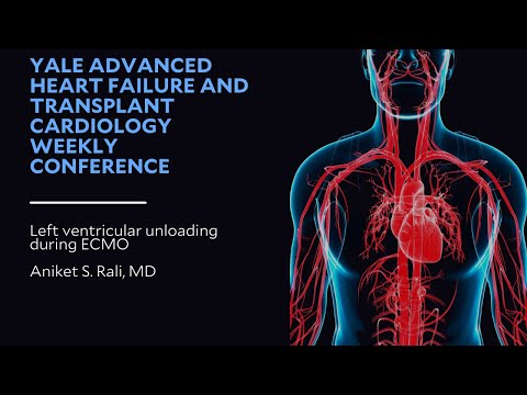 Left ventricular unloading during ECMO