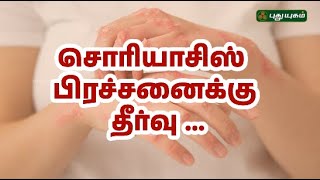 28-06-2023 Doctor On Call-PuthuYugam tv Show