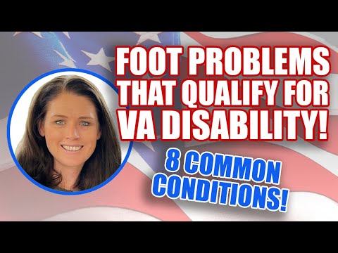 What Foot Problems Qualify for VA Disability? 8 Common Conditions!