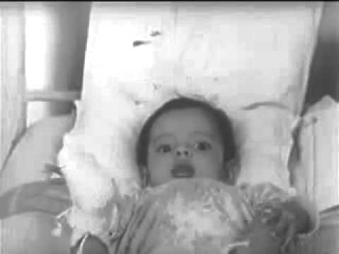 Emotional Deprivation in Infancy  Study by Rene A. Spitz 1952