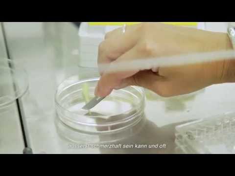 Videolaserverdampfung von Prostata-Adenom Was Exazerbation einer chronischen Prostatitis