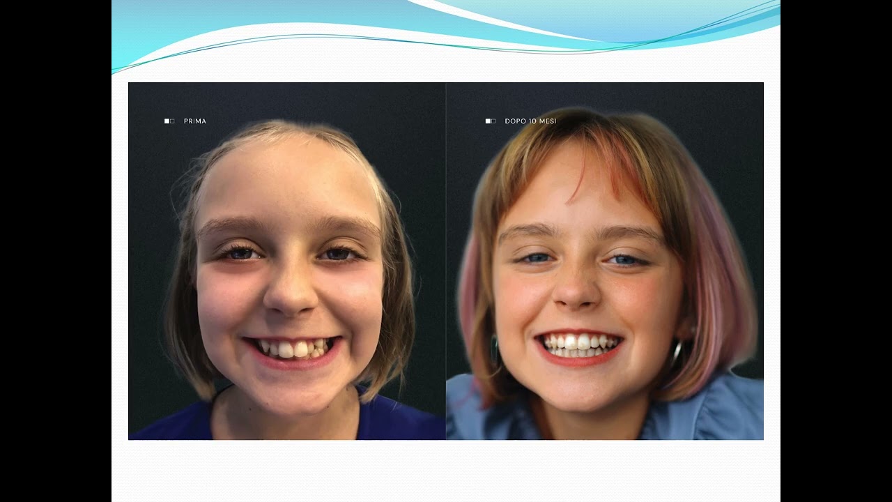 NAPOLI DENTAL CARE: LA SPA PER IL TUO SORRISO