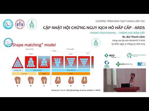 #4- O que acontece com a SDRA