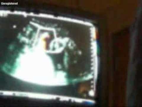 2006-10-23 Sonogram #2