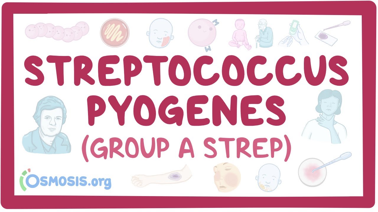 Streptococcus pyogenes (Group A Strep) - causes, symptoms, diagnosis, treatment, pathology - YouTube