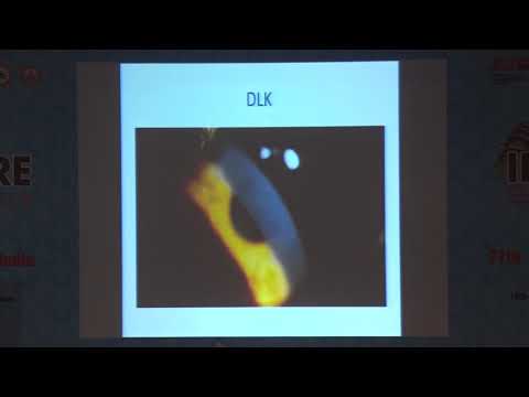 AIOC2019 - GP018 - A closer look at Atypical Keratitis: Clinical case scenarios