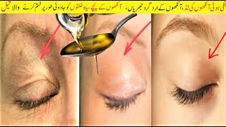How To Treat Droopy Eyelids, Eyes Dark Circles Fine line and Naturally ( Amazing Result..100% Works)