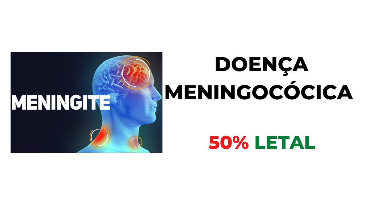 MENINGITE: CONHEÇA OS SINTOMAS, CAUSAS E TRATAMENTO