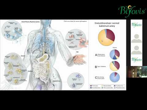 fertőzött papilloma choroid plexus papilloma sugárterápia