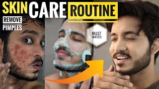 EASY & BEST Skin Care Routine For BOYS & MEN | Remove Acne, Pimples & Darkspots FAST 🔥🔥