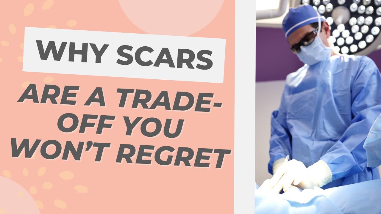 Why Scars are a Trade-Off You Won’t Regret