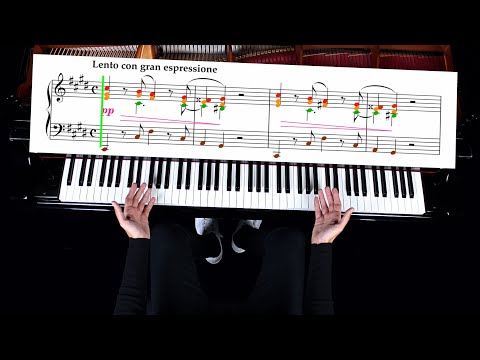 Chopin – Nocturne in C♯ Minor Op. Posth. No. 20 | Complete Piano Tutorial