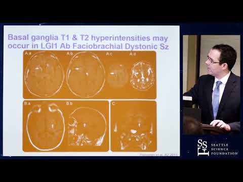Clinical Pearls in Autoimmune Encephalopathy - Eoin Flanagan, M.D.