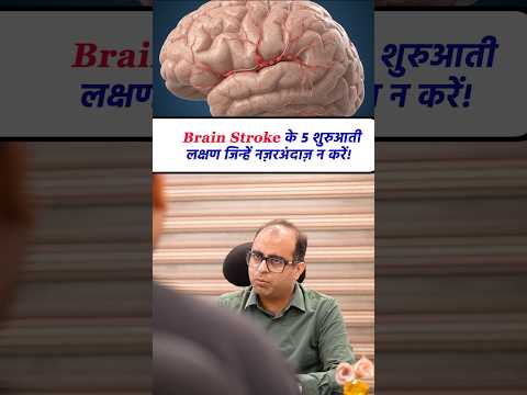 5 Early Signs of a Brain Stroke You Should Never Ignore! 🚨