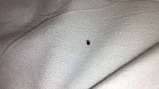 Bedbugs at the Fairfield Inn - Philadelphia