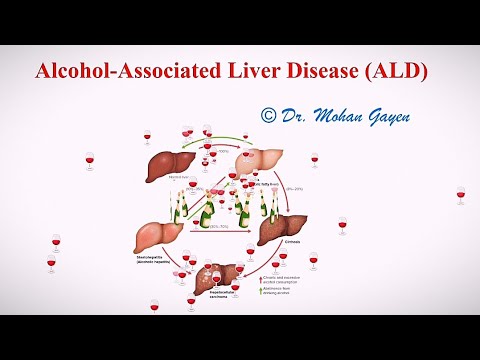 Alcohol-Associated Liver Disease(ALD) | Alcoholic Hepatitis | © Dr. Mohan Gayen