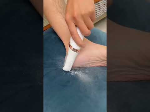 Electric Foot Callus Remover