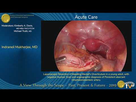 Laparoscopic Resection of Bleeding Meckel's Diverticulum in a Young Adult