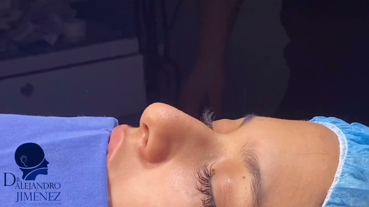 Alejandro Jimenez Garcia-55