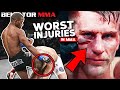 Most GRUESOME Fight Ending Injuries | Bellator MMA