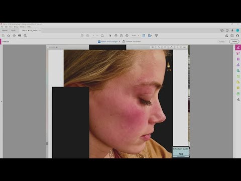 Johnny Depp Trial: Photos shown of Amber Heard after May 2016 altercation with Depp | FOX 5 DC