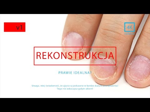 Koślawego oraz korektor Kup Nakładki na palcach nasion