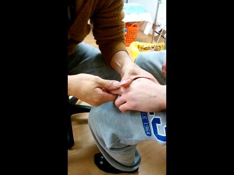 指の脱臼 - 指の脱臼とは何か、治療方法、症状、対処法