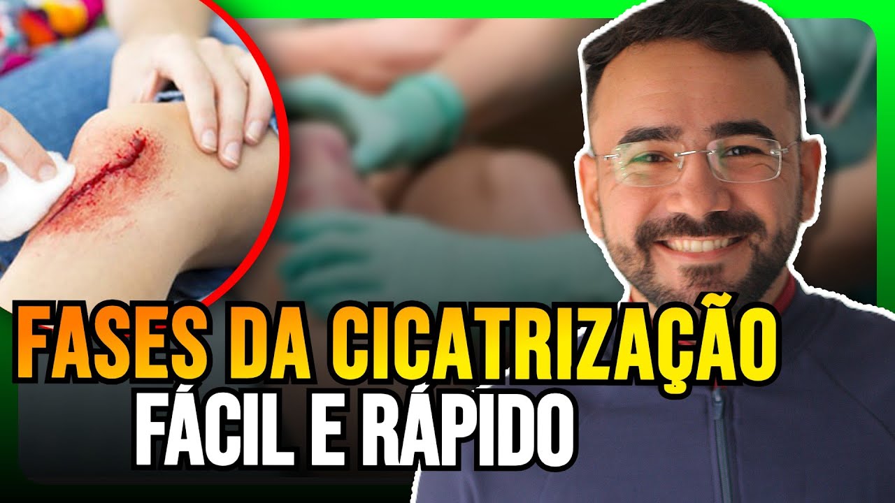 FASES DA CICATRIZAÇÃO: ENTENDA TUDO SOBRE AS FASES DA CICATRIZAÇÃO FÁCIL