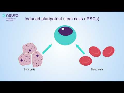 Accelerating drug discovery to help people with brain diseases
