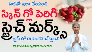 వీటితో ఇలా చేయండి SKIN GLOW పెరిగి స్ట్రెచ్ మర్క్స్ రావు | Dr Manthena Satyanarayana Raju Videos