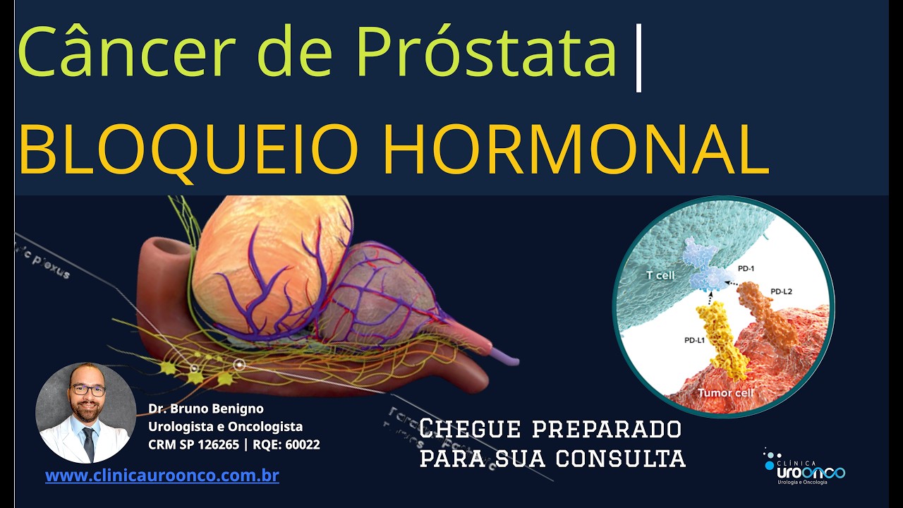 Próstata | Bloqueio de Testosterona | Quando indicamos, efeitos colaterais e quais as alternativas