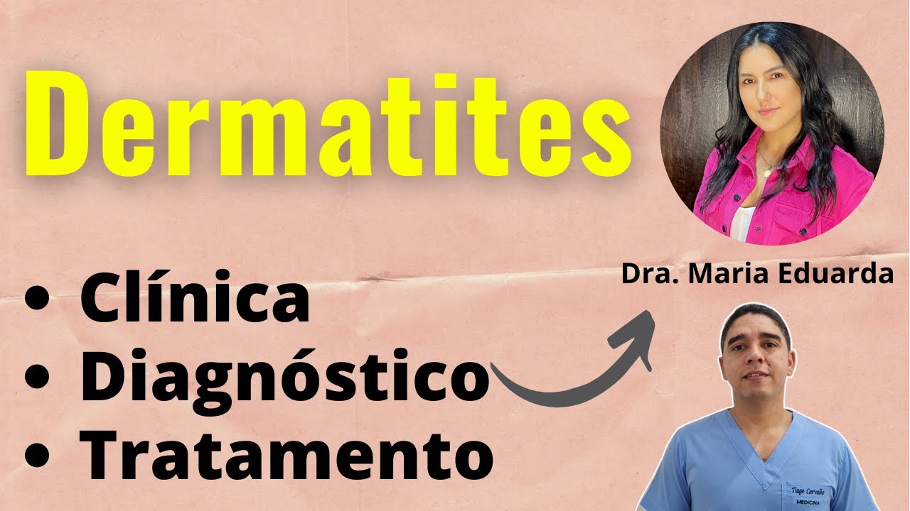 Dermatite Alérgica e Dermatite de Contato
