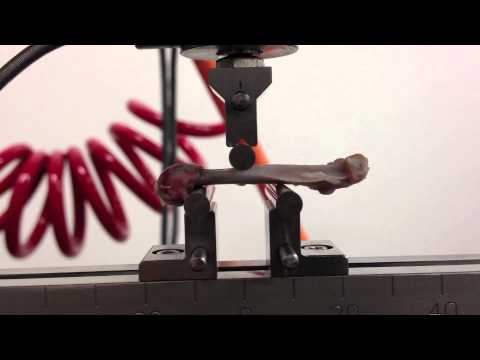 SURE 2013: Ex-Vivo Detection of Bone Microdamage Using Different Staining Techniques