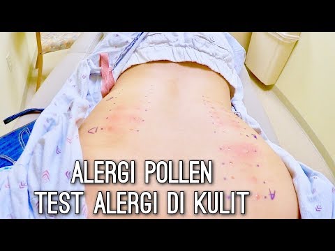 Yang mempengaruhi potensi pada pria Tetes patogen kuda