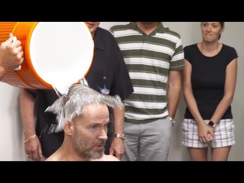 Hair Fibers vs DermMatch: Hair loss concealer live comparison.