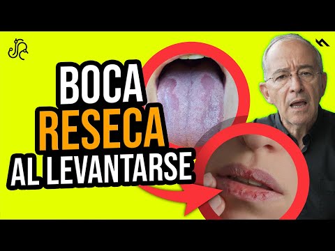 ATENCIÓN A BOCA RESECA Cuando ME LEVANTO, ES POR ESTA RAZÓN - Oswaldo Restrepo RSC