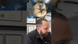 Download lagu Would hate to have a cavity like THIS ONE⬆️⬆️👀 Better just to come in for your checkups😁❤️ mp3 Download lagu Would hate to have a cavity like THIS ONE⬆️⬆️👀 Better just to come in for your checkups😁❤️ mp3