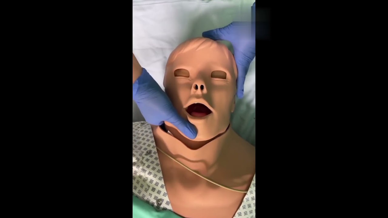 Airway techniques #Anaesthesiology#critical care#icu
