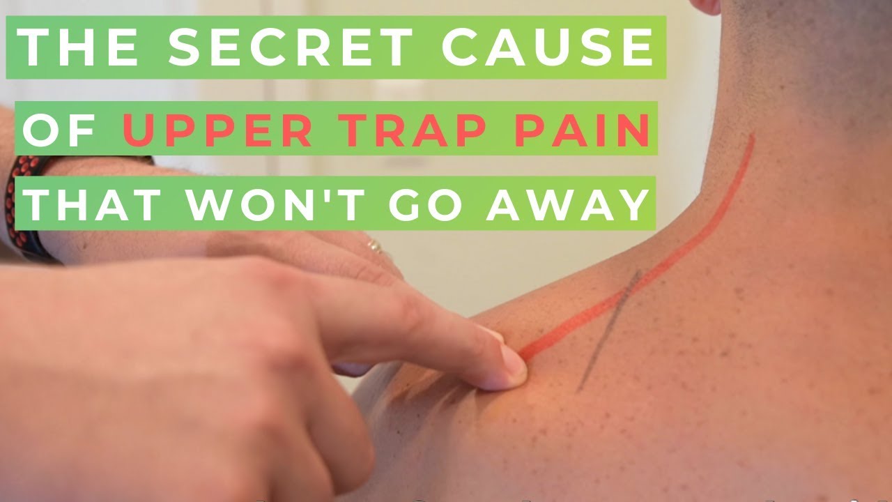 What is trapezius myalgia syndrome? More REF